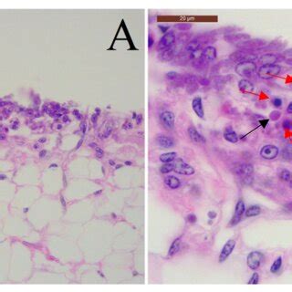 bad feh pos tsv|Detection of Taura Syndrome Virus (TSV) and Yellow Head Virus .